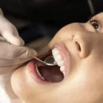 Dental Nurse Job in Saudi Arabia